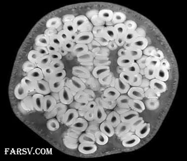 عکس MRI از انار