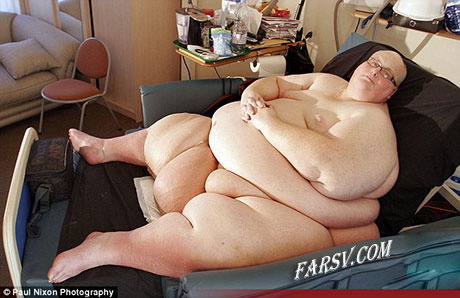 چاق ترین مرد جهان پس از عمل جراحی! + تصاویر چاق ترین مرد جهان
