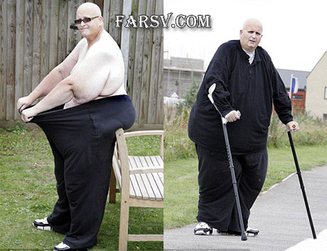 چاق ترین مرد جهان پس از عمل جراحی! + تصاویر چاق ترین مرد جهان