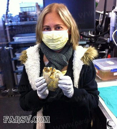 دختری که قلب خودش را در دست گرفت! + عکس دختری که قلبش را در دست گرفت