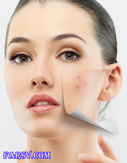 درمان جوشهای صورت به روش چینی! درمان جوش صورت به روش چینی