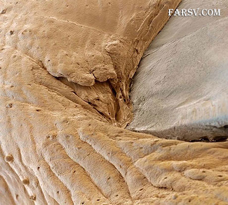 عکس ناخن انسان