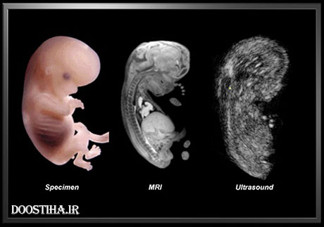 عکس سونوگرافی از شکم مادر