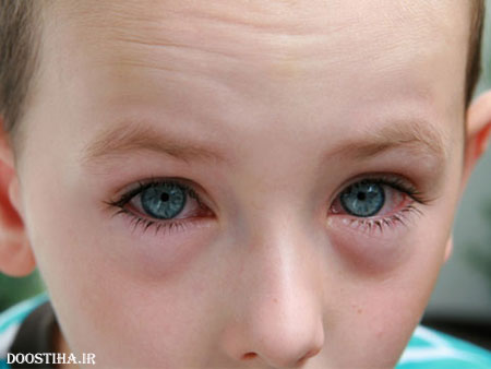 13 رازی که چشم پزشکان به شما نمی گویند! رازهای پنهان چشم پزشکان