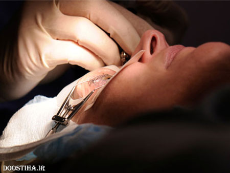 13 رازی که چشم پزشکان به شما نمی گویند! رازهای پنهان چشم پزشکان