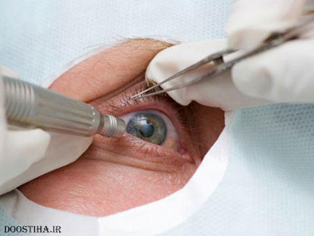 13 رازی که چشم پزشکان به شما نمی گویند! رازهای پنهان چشم پزشکان