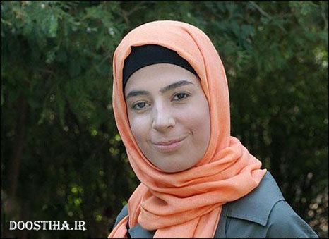 غزاله جزایری بعد از عمل جراحی زیبایی