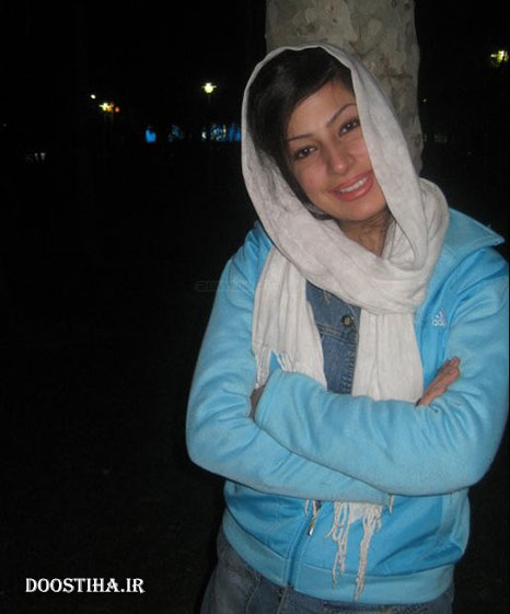 غزاله جزایری بعد از عمل جراحی زیبایی