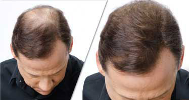 موهای پرپشت