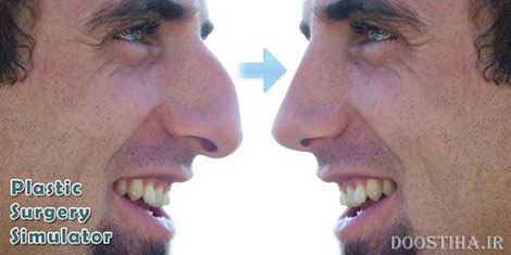 دانلود نرم افزار جراحی پلاستیک Plastic Surgery Simulator