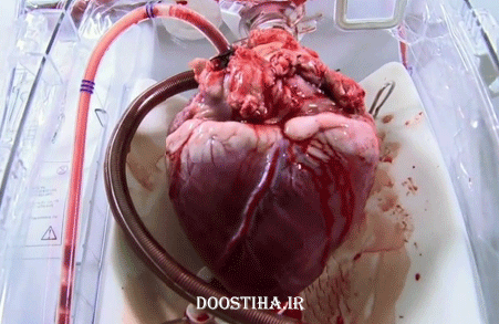 عکس متحرک از پمپاژ و تپش قلب