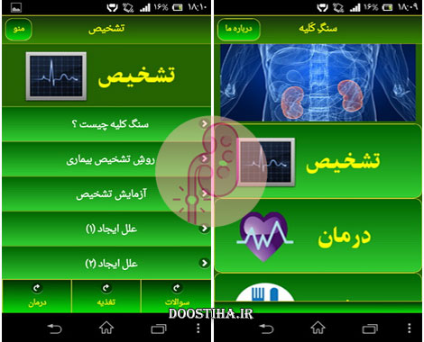 دانلود نرم افزار تخصصی سنگ کلیه