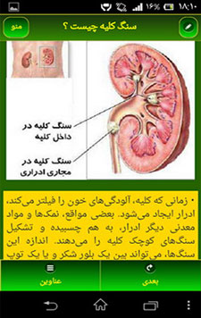 پیشگیری، تشخیص و درمان سنگ کلیه